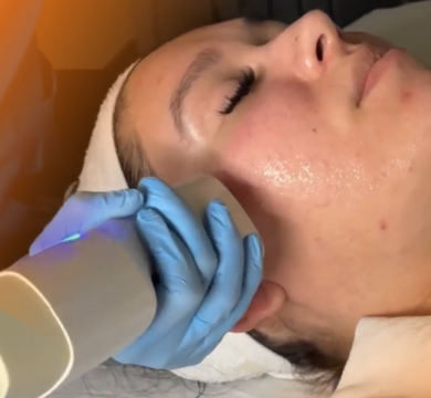 "Latina woman receiving a Glacial Skin Treatment on her face"