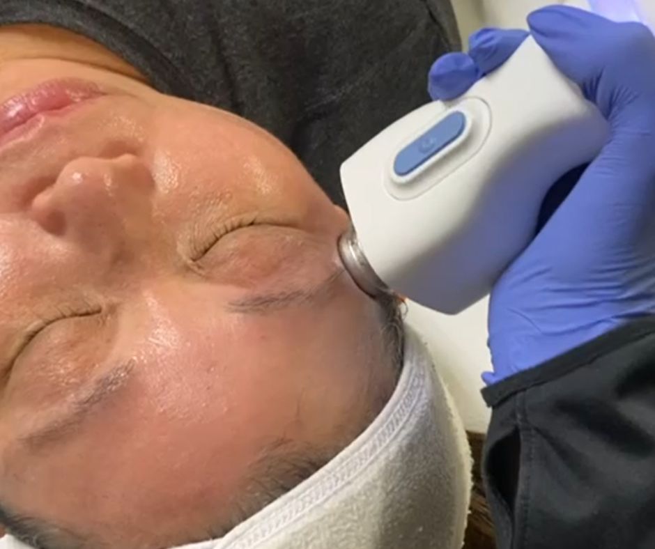 "An Asian woman doing a glacial skin treatment"