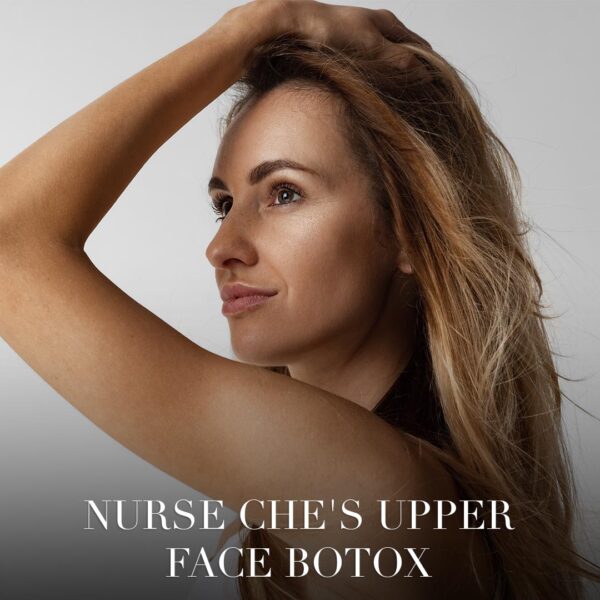 Upper Face Botox